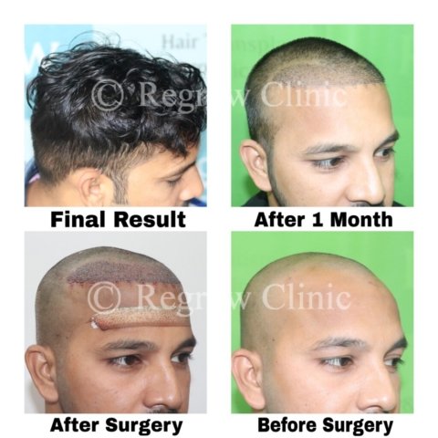 Before - After Treatment Images of Patients Before - After Treatment Images of Patients