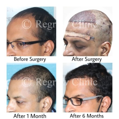 Before - After Treatment Images of Patients Before - After Treatment Images of Patients
