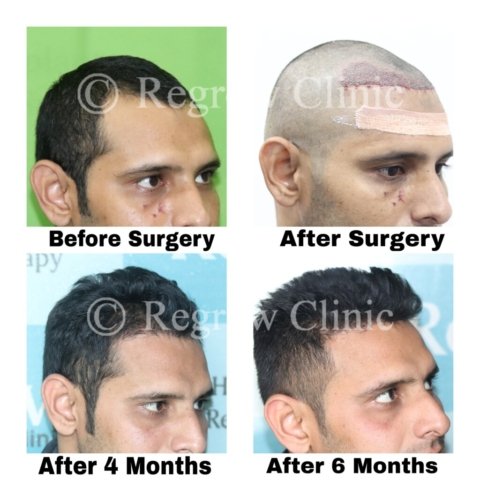 Before - After Treatment Images of Patients Before - After Treatment Images of Patients