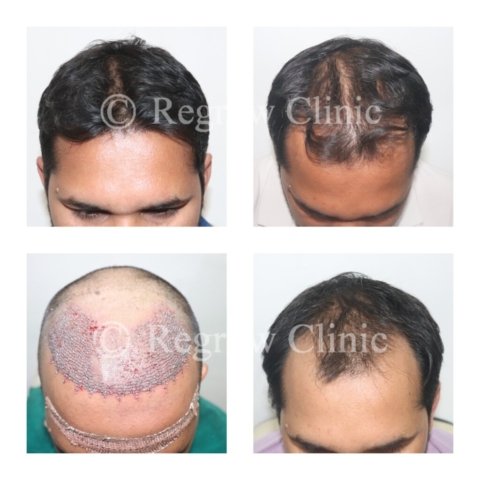 Before - After Treatment Images of Patients Before - After Treatment Images of Patients