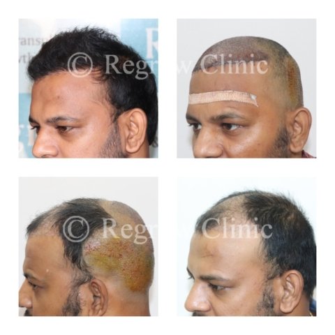 Before - After Treatment Images of Patients Before - After Treatment Images of Patients