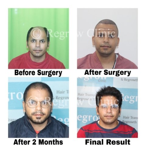 Before - After Treatment Images of Patients Before - After Treatment Images of Patients