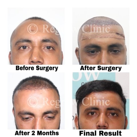 Before - After Treatment Images of Patients Before - After Treatment Images of Patients