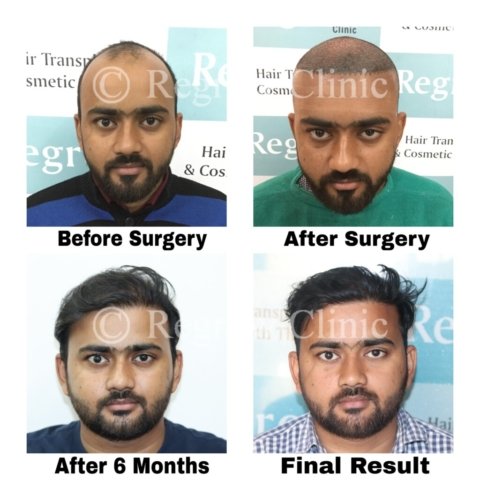 Before - After Treatment Images of Patients Before - After Treatment Images of Patients