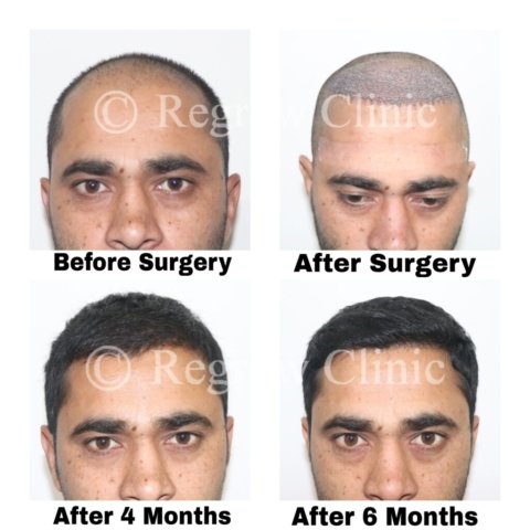 Before - After Treatment Images of Patients Before - After Treatment Images of Patients