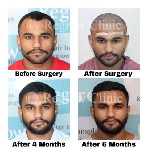 Before - After Treatment Images of Patients Before - After Treatment Images of Patients