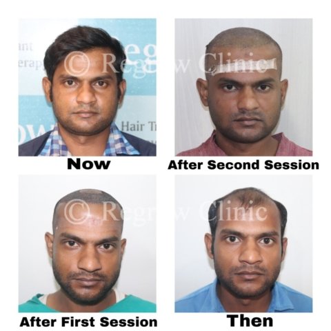 Before - After Treatment Images of Patients Before - After Treatment Images of Patients