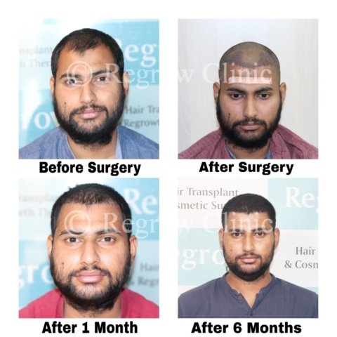 Before - After Treatment Images of Patients Before - After Treatment Images of Patients