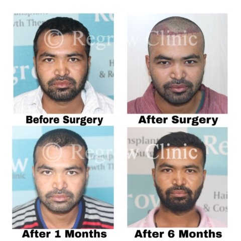 Before - After Treatment Images of Patients Before - After Treatment Images of Patients