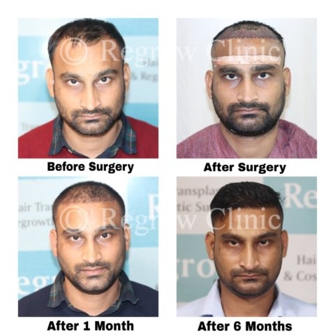 Before - After Treatment Images of Patients Before - After Treatment Images of Patients