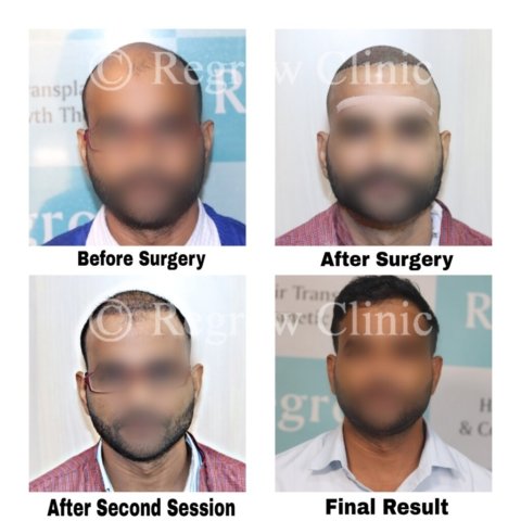 Before - After Treatment Images of Patients Before - After Treatment Images of Patients