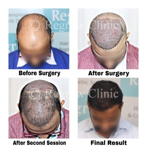 Before - After Treatment Images of Patients Before - After Treatment Images of Patients