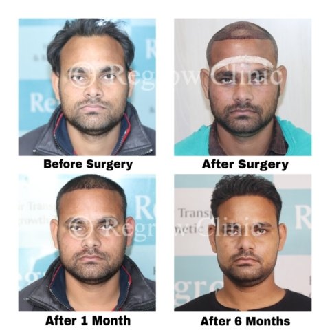 Before - After Treatment Images of Patients Before - After Treatment Images of Patients