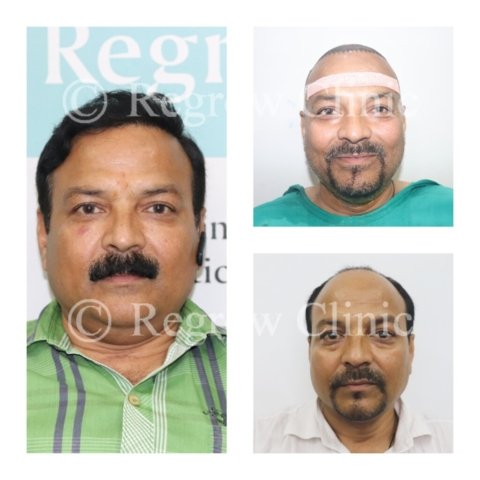 Before - After Treatment Images of Patients Before - After Treatment Images of Patients
