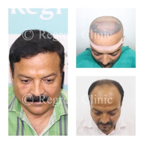 Before - After Treatment Images of Patients Before - After Treatment Images of Patients