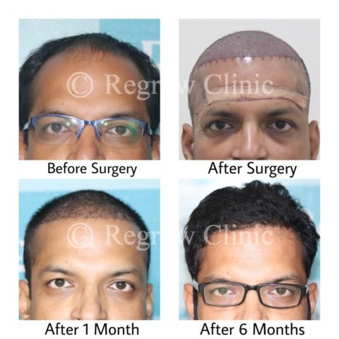 Before - After Treatment Images of Patients Before - After Treatment Images of Patients