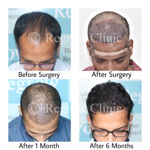 Before - After Treatment Images of Patients Before - After Treatment Images of Patients