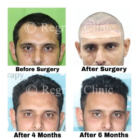 Before - After Treatment Images of Patients Before - After Treatment Images of Patients