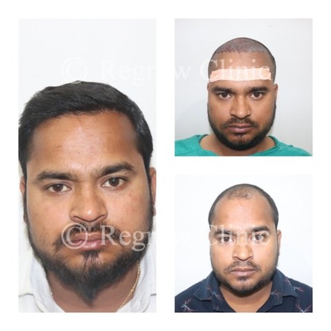 Before - After Treatment Images of Patients Before - After Treatment Images of Patients