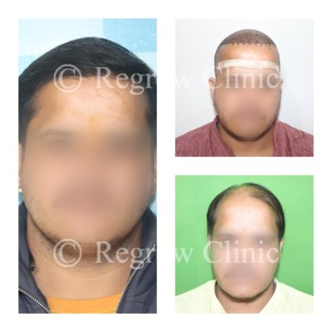 Before - After Treatment Images of Patients Before - After Treatment Images of Patients