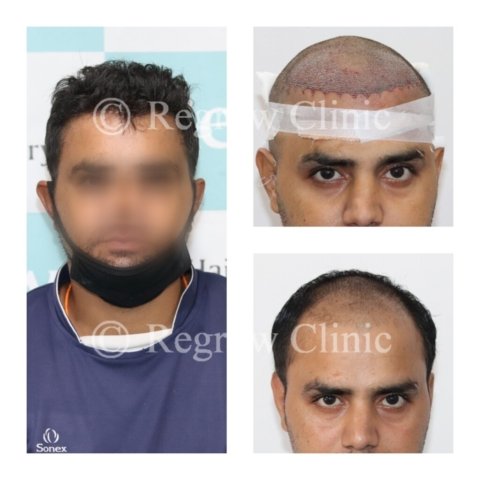 Before - After Treatment Images of Patients Before - After Treatment Images of Patients
