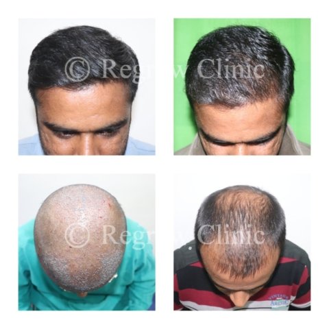 Before - After Treatment Images of Patients Before - After Treatment Images of Patients