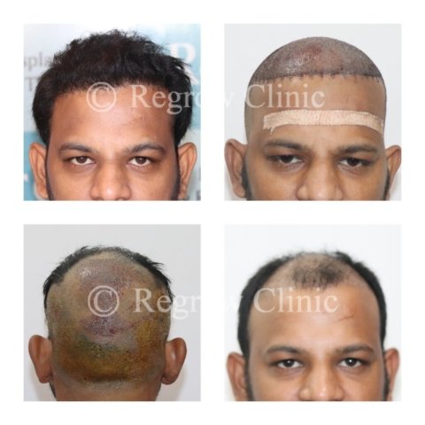 Before - After Treatment Images of Patients Before - After Treatment Images of Patients