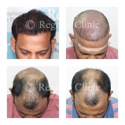 Before - After Treatment Images of Patients Before - After Treatment Images of Patients