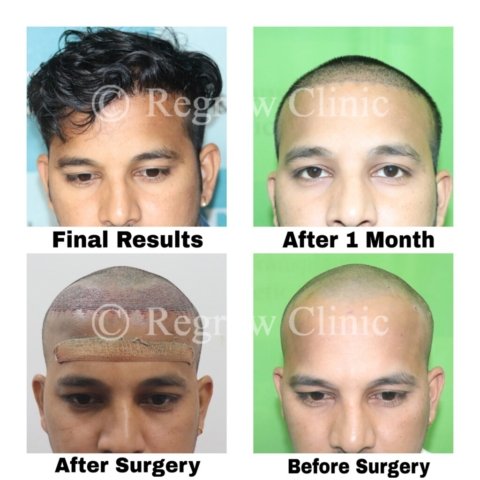 Before - After Treatment Images of Patients Before - After Treatment Images of Patients