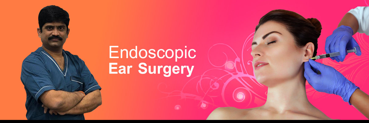 Endoscopic ear surgery in Visakhapatnam Endoscopic ear surgery in Visakhapatnam