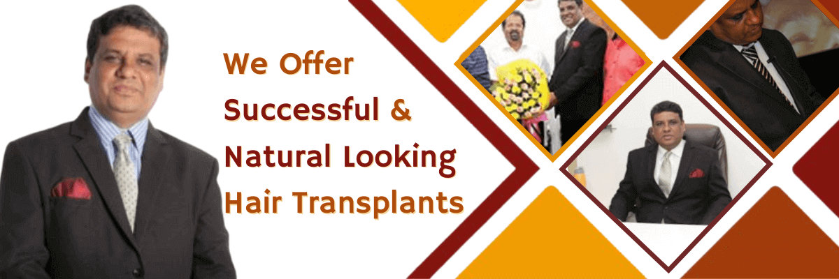 Hair Transplant in Bengaluru