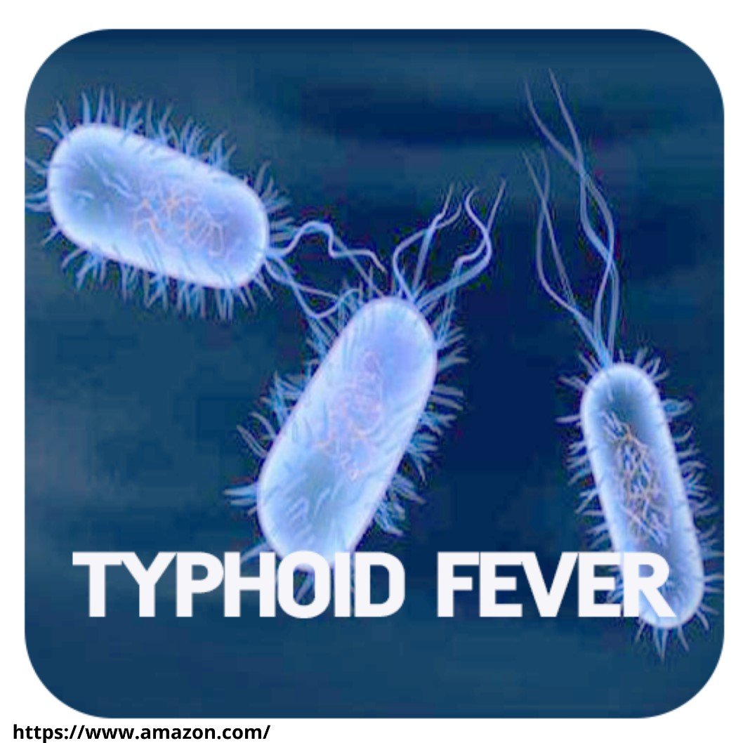 typhoid fever