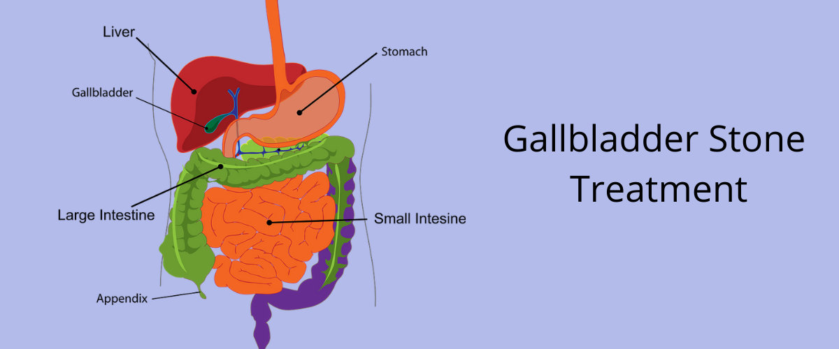 Gallbladder Stones Gallbladder Stones