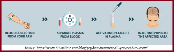 Platelet-rich plasma therapy