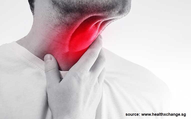 Tonsillitis