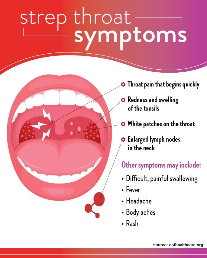 strep throat symptoms