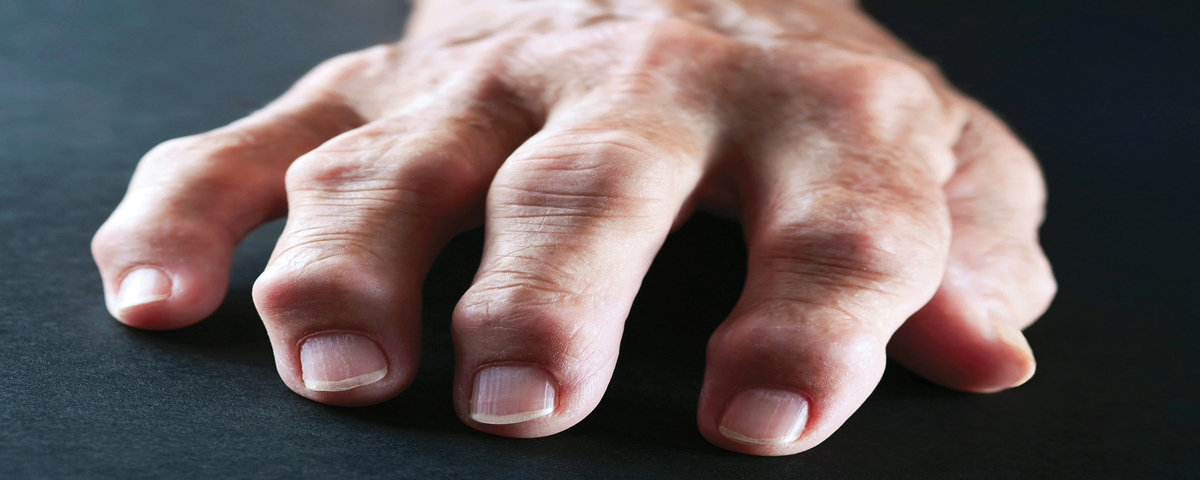 arthritis treatment in Mumbai arthritis treatment in Mumbai