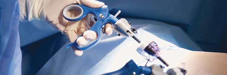 Laparoscopic Bariatric Surgery Laparoscopic Bariatric Surgery