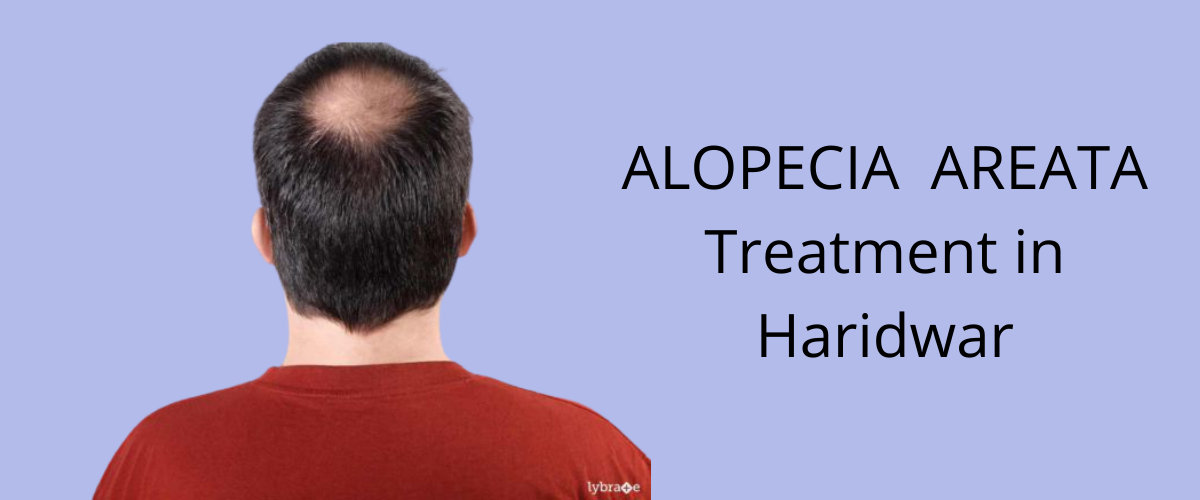 patchy hair treatment patchy hair treatment