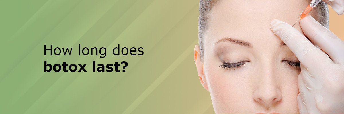 How long does Botox last in Migraine Treatment How long does Botox last in Migraine Treatment