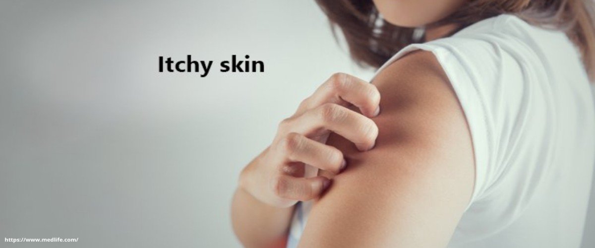 Skin itching Skin itching