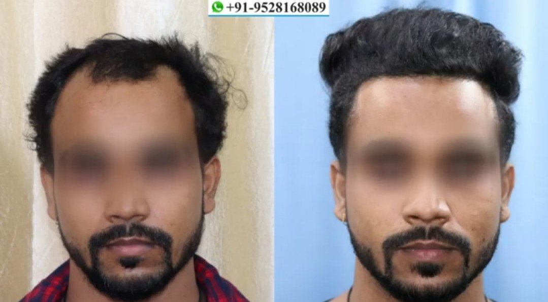 Before - After Images of the patient