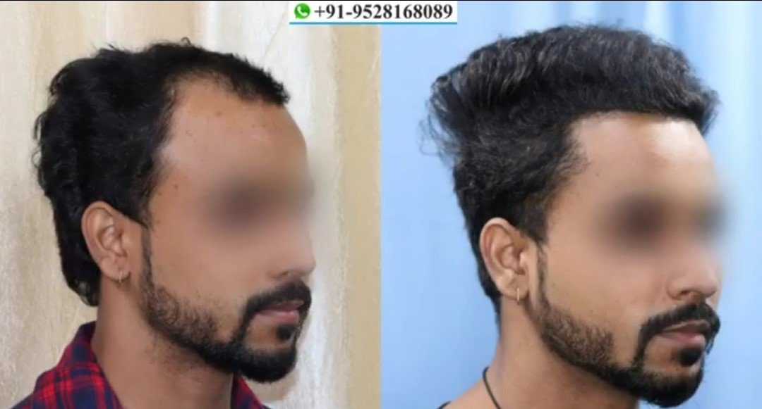 Before - After Images of the patient