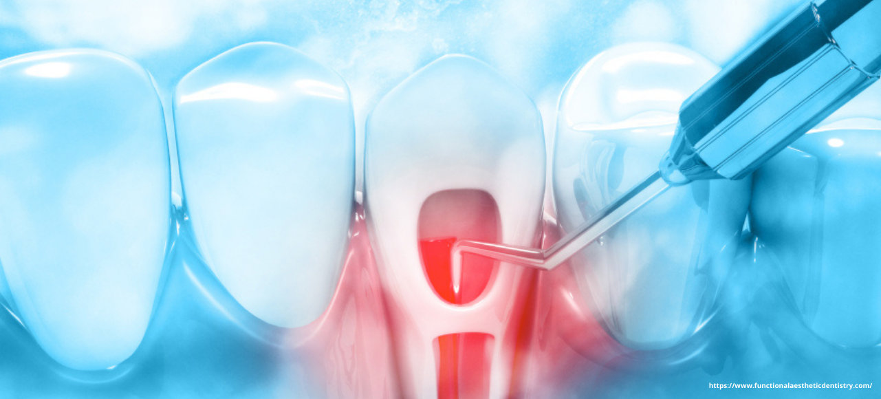 Laser dentistry Laser dentistry