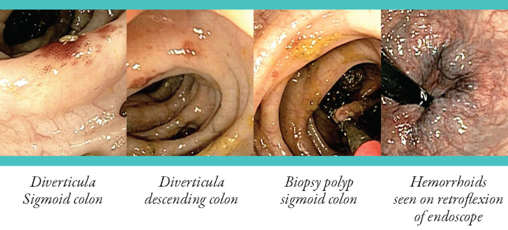 colonoscopy_page_7