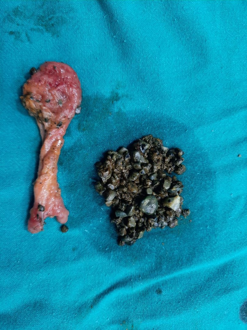 laparoscopic