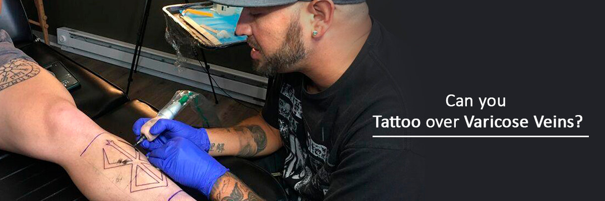 For Varicose Veins Choose Treatment Over Tattoos  CVR Blog