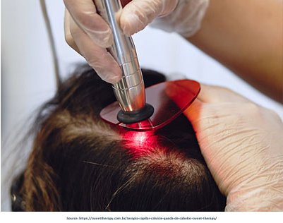 process for laser therapy for hair loss in Mumba