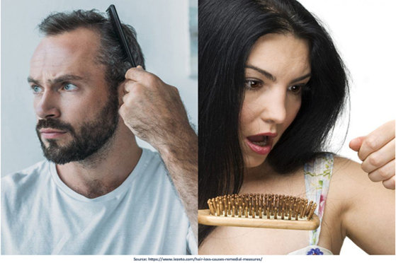 laser therapy for hair loss in Mumba