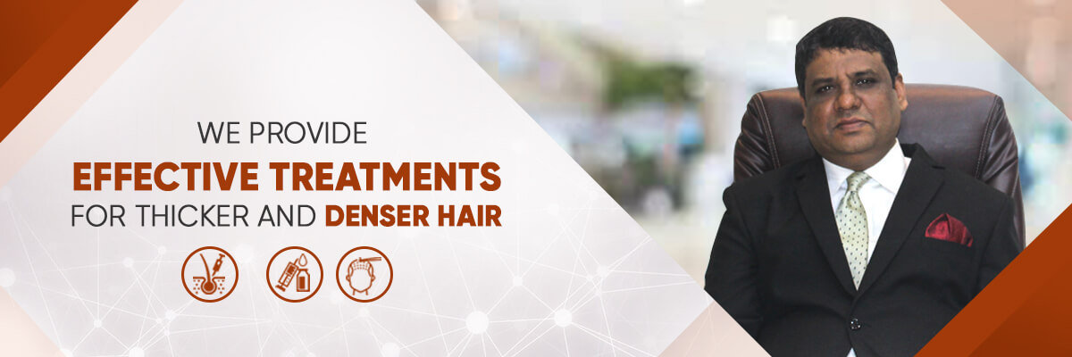 Laser Therapy for Hair Loss